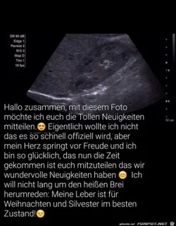 65df644f108df0e8_x300_y000.webp